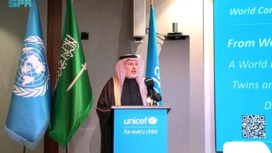 المملكة حريصة على الاهتمام بحالات التوائم الملتصقة